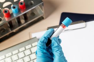 Biological Age Testing