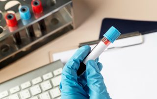 Biological Age Testing