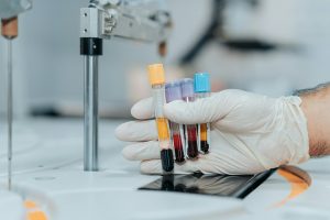 Chronic Inflammation Test Chronic Inflammation Test